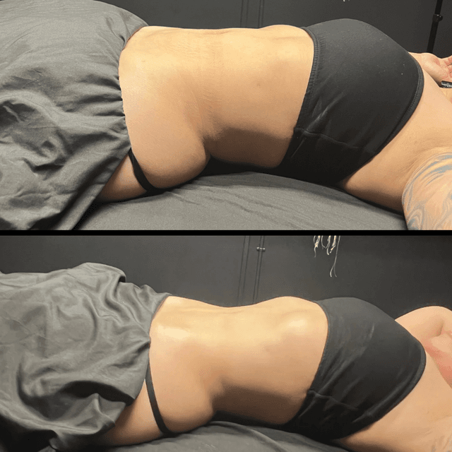 Lymphatic LUXE package deal at Trinity Wellness Co. in Riverside, CA